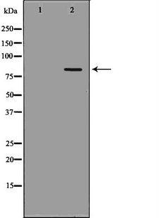 POLH / DNA Polymerase Eta Antibody - Western blot analysis of extracts of A431 cells using POLH antibody. The lane on the left is treated with the antigen-specific peptide.