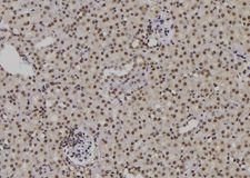 POLH / DNA Polymerase Eta Antibody - 1:100 staining mouse kidney tissue by IHC-P. The sample was formaldehyde fixed and a heat mediated antigen retrieval step in citrate buffer was performed. The sample was then blocked and incubated with the antibody for 1.5 hours at 22°C. An HRP conjugated goat anti-rabbit antibody was used as the secondary.