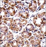 POLI Antibody - POLI Antibody immunohistochemistry of formalin-fixed and paraffin-embedded human stomach tissue followed by peroxidase-conjugated secondary antibody and DAB staining.