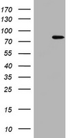 POLI Antibody - HEK293T cells were transfected with the pCMV6-ENTRY control (Left lane) or pCMV6-ENTRY POLI (Right lane) cDNA for 48 hrs and lysed. Equivalent amounts of cell lysates (5 ug per lane) were separated by SDS-PAGE and immunoblotted with anti-POLI.