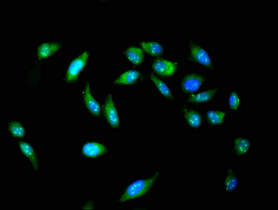 POLI Antibody - Immunofluorescent analysis of Hela cells at a dilution of 1:100 and Alexa Fluor 488-congugated AffiniPure Goat Anti-Rabbit IgG(H+L)