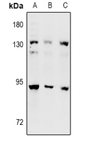 POLI Antibody - Western blot analysis of DNA Polymerase iota expression in A549 (A), U87MG (B), MCF7 (C) whole cell lysates.