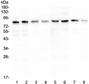 POLI Antibody - Western blot testing of rat 1) testis, 2) testis, 3) kidney, 4) stomach and mouse 5) testis, 6) testis, 7) kidney and 8) stomach lysate with DNA Polymerase iota antibody at 0.5ug/ml. Predicted molecular weight ~83 kDa.