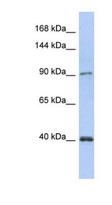 POLK / DNA Polymerase Kappa Antibody - POLK antibody Western blot of Fetal Kidney lysate. This image was taken for the unconjugated form of this product. Other forms have not been tested.