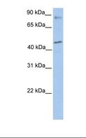 POLK / DNA Polymerase Kappa Antibody - 721_B cell lysate. Antibody concentration: 1.0 ug/ml. Gel concentration: 12%.  This image was taken for the unconjugated form of this product. Other forms have not been tested.