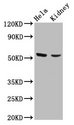 POLK / DNA Polymerase Kappa Antibody - Positive Western Blot detected in Hela whole cell lysate, Mouse kidney tissue. All lanes: POLK antibody at 4.2 µg/ml Secondary Goat polyclonal to rabbit IgG at 1/50000 dilution. Predicted band size:99, 55, 77, 43, 56, 53, 43, 89 KDa. Observed band size: 55 KDa