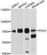POLK / DNA Polymerase Kappa Antibody - Western blot analysis of extracts of various cell lines, using POLK antibody at 1:1000 dilution. The secondary antibody used was an HRP Goat Anti-Rabbit IgG (H+L) at 1:10000 dilution. Lysates were loaded 25ug per lane and 3% nonfat dry milk in TBST was used for blocking. An ECL Kit was used for detection and the exposure time was 5s.