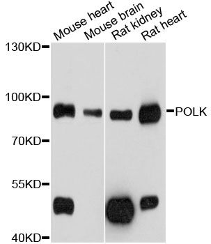 POLK / DNA Polymerase Kappa Antibody - Western blot analysis of extracts of various cell lines, using POLK antibody at 1:1000 dilution. The secondary antibody used was an HRP Goat Anti-Rabbit IgG (H+L) at 1:10000 dilution. Lysates were loaded 25ug per lane and 3% nonfat dry milk in TBST was used for blocking. An ECL Kit was used for detection and the exposure time was 5s.