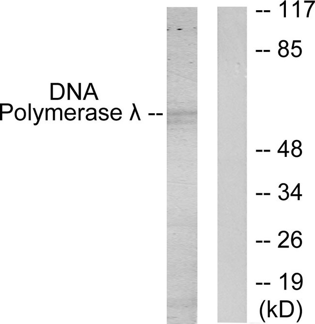 POLL / DNA Polymerase Lambda Antibody - Western blot analysis of lysates from 293 cells, using DNA Polymerase lambda Antibody. The lane on the right is blocked with the synthesized peptide.
