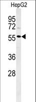 POLL / DNA Polymerase Lambda Antibody - Western blot of POLL Antibody in HepG2 cell line lysates (35 ug/lane). POLL (arrow) was detected using the purified antibody.