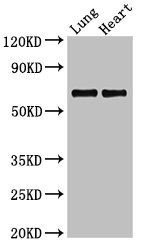 POLL / DNA Polymerase Lambda Antibody - Western Blot Positive WB detected in:Rat lung tissue,Rat heart tissue All Lanes:POLL antibody at 2.4µg/ml Secondary Goat polyclonal to rabbit IgG at 1/50000 dilution Predicted band size: 64,34 KDa Observed band size: 64 KDa