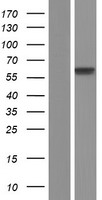 POLL / DNA Polymerase Lambda Protein - Western validation with an anti-DDK antibody * L: Control HEK293 lysate R: Over-expression lysate