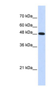 POLM / DNA Polymerase Mu Antibody - POLM antibody Western blot of Transfected 293T cell lysate. This image was taken for the unconjugated form of this product. Other forms have not been tested.