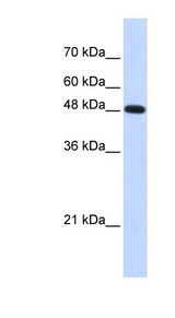 POLM / DNA Polymerase Mu Antibody - POLM antibody Western blot of Transfected 293T cell lysate. This image was taken for the unconjugated form of this product. Other forms have not been tested.