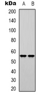 POLM / DNA Polymerase Mu Antibody - Western blot analysis of DNA Polymerase mu expression in K562 (A); Jurkat (B) whole cell lysates.