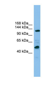 POLR1B Antibody - POLR1B antibody Western blot of ACHN lysate. This image was taken for the unconjugated form of this product. Other forms have not been tested.