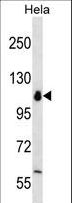 POLR1B Antibody - POLR1B Antibody western blot of HeLa cell line lysates (35 ug/lane). The POLR1B antibody detected the POLR1B protein (arrow).
