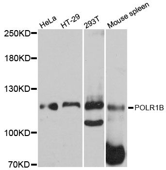POLR1B Antibody - Western blot analysis of extracts of various cell lines, using POLR1B antibody at 1:3000 dilution. The secondary antibody used was an HRP Goat Anti-Rabbit IgG (H+L) at 1:10000 dilution. Lysates were loaded 25ug per lane and 3% nonfat dry milk in TBST was used for blocking. An ECL Kit was used for detection and the exposure time was 10s.