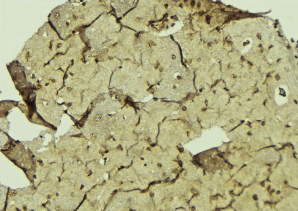 POLR1B Antibody - 1:100 staining mouse brain tissue by IHC-P. The sample was formaldehyde fixed and a heat mediated antigen retrieval step in citrate buffer was performed. The sample was then blocked and incubated with the antibody for 1.5 hours at 22°C. An HRP conjugated goat anti-rabbit antibody was used as the secondary.