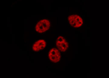 POLR1B Antibody - Staining HeLa cells by IF/ICC. The samples were fixed with PFA and permeabilized in 0.1% Triton X-100, then blocked in 10% serum for 45 min at 25°C. The primary antibody was diluted at 1:200 and incubated with the sample for 1 hour at 37°C. An Alexa Fluor 594 conjugated goat anti-rabbit IgG (H+L) antibody, diluted at 1/600, was used as secondary antibody.