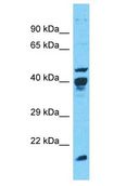 POLR1C / RPA39 Antibody - POLR1C / RPA39 antibody Western Blot of Jurkat. Antibody dilution: 1 ug/ml.  This image was taken for the unconjugated form of this product. Other forms have not been tested.