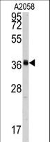 POLR1C / RPA39 Antibody - Western blot of anti-POLR1C Antibody in A2058 cell line lysates (35 ug/lane). POLR1C (arrow) was detected using the purified antibody.
