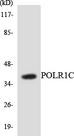 POLR1C / RPA39 Antibody - Western blot analysis of the lysates from HepG2 cells using POLR1C antibody.