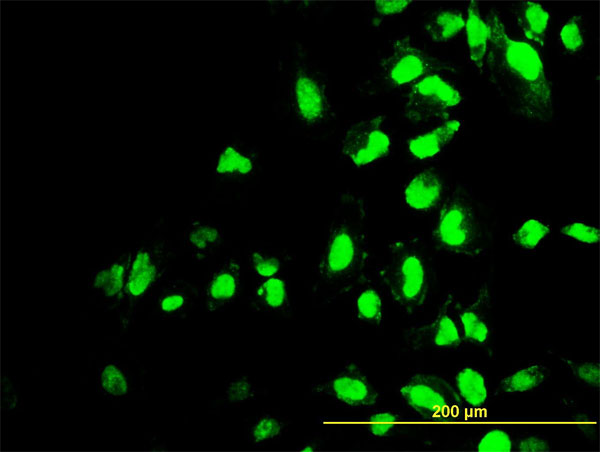 POLR1C / RPA39 Antibody - Immunofluorescence of monoclonal antibody to POLR1C on HeLa cell. [antibody concentration 7 ug/ml]