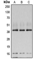 POLR1C / RPA39 Antibody - Western blot analysis of POLR1C expression in SW480 (A); K562 (B); NIH3T3 (C) whole cell lysates.