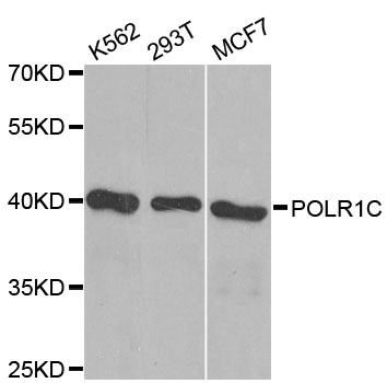 POLR1C / RPA39 Antibody - Western blot analysis of extracts of various cell lines, using POLR1C antibody at 1:1000 dilution. The secondary antibody used was an HRP Goat Anti-Rabbit IgG (H+L) at 1:10000 dilution. Lysates were loaded 25ug per lane and 3% nonfat dry milk in TBST was used for blocking. An ECL Kit was used for detection and the exposure time was 90s.