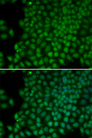 POLR1C / RPA39 Antibody - Immunofluorescence analysis of HeLa cells using POLR1C antibody. Blue: DAPI for nuclear staining.