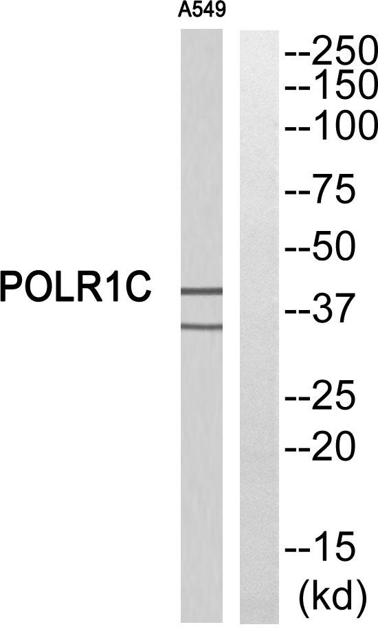 POLR1C / RPA39 Antibody - Western blot analysis of extracts from A549 cells, using POLR1C antibody.
