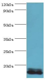 POLR1D Antibody - Western blot. All lanes: DNA-directed RNA polymerases I and III subunit RPAC2 antibody at 10 ug/ml+Jurkat whole cell lysate. Secondary antibody: Goat polyclonal to rabbit at 1:10000 dilution. Predicted band size: 15 kDa. Observed band size: 15 kDa Immunohistochemistry.