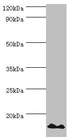 POLR1D Antibody - Western blot All lanes: DNA-directed RNA polymerases I and III subunit RPAC2 antibody at 10µg/ml + Jurkat whole cell lysate Secondary Goat polyclonal to rabbit IgG at 1/10000 dilution Predicted band size: 16, 15 kDa Observed band size: 16 kDa