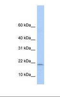 POLR1D Antibody - Fetal lung lysate. Antibody concentration: 1.0 ug/ml. Gel concentration: 10-20%.  This image was taken for the unconjugated form of this product. Other forms have not been tested.