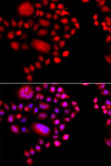 POLR1D Antibody - Immunofluorescence analysis of A549 cells.