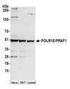 POLR1E Antibody - Detection of human POLR1E/PRAF1 by western blot. Samples: Whole cell lysate (50 µg) from HeLa, HEK293T, and Jurkat cells prepared using NETN lysis buffer. Antibody: Affinity purified rabbit anti-POLR1E/PRAF1 antibody used for WB at 0.1 µg/ml. Detection: Chemiluminescence with an exposure time of 3 minutes.