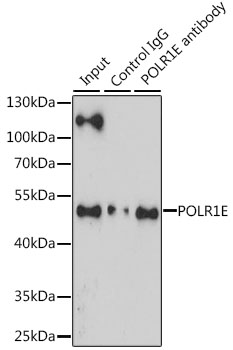 POLR1E Antibody - Immunoprecipitation analysis of 200ug extracts of Jurkat cells, using 3 ug POLR1E antibody. Western blot was performed from the immunoprecipitate using POLR1E antibody at a dilition of 1:1000.