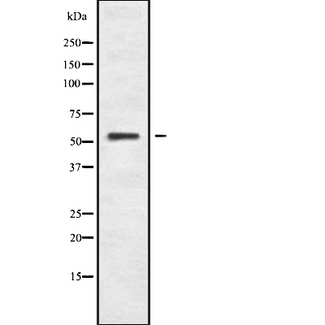 POLR1E Antibody - Western blot analysis of RPA49 using K562 whole cells lysates