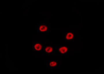 POLR1E Antibody - Staining HeLa cells by IF/ICC. The samples were fixed with PFA and permeabilized in 0.1% Triton X-100, then blocked in 10% serum for 45 min at 25°C. The primary antibody was diluted at 1:200 and incubated with the sample for 1 hour at 37°C. An Alexa Fluor 594 conjugated goat anti-rabbit IgG (H+L) Ab, diluted at 1/600, was used as the secondary antibody.
