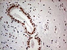 POLR2A / RNA polymerase II Antibody - Immunohistochemical staining of paraffin-embedded Human breast tissue within the normal limits using anti-POLR2A mouse monoclonal antibody. (Heat-induced epitope retrieval by 1mM EDTA in 10mM Tris buffer. (pH8.5) at 120°C for 3 min. (1:500)