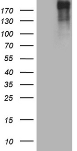 POLR2A / RNA polymerase II Antibody - HEK293T cells were transfected with the pCMV6-ENTRY control. (Left lane) or pCMV6-ENTRY POLR2A. (Right lane) cDNA for 48 hrs and lysed. Equivalent amounts of cell lysates. (5 ug per lane) were separated by SDS-PAGE and immunoblotted with anti-POLR2A. (1:2000)