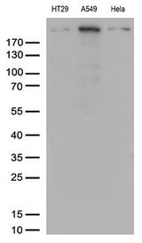 POLR2A / RNA polymerase II Antibody - Western blot analysis of extracts. (35ug) from 3 different cell lines by using anti-POLR2A monoclonal antibody. 1:500`