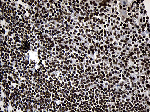 POLR2A / RNA polymerase II Antibody - Immunohistochemical staining of paraffin-embedded Human tonsil within the normal limits using anti-POLR2A mouse monoclonal antibody. (Heat-induced epitope retrieval by 1mM EDTA in 10mM Tris buffer. (pH8.5) at 120°C for 3 min. (1:500)