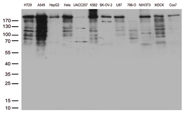 POLR2A / RNA polymerase II Antibody - Western blot analysis of extracts. (35ug) from 7 different cell lines by using anti-POLR2A monoclonal antibody. (1:500)
