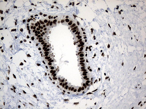 POLR2A / RNA polymerase II Antibody - Immunohistochemical staining of paraffin-embedded Human breast tissue within the normal limits using anti-POLR2A mouse monoclonal antibody. (Heat-induced epitope retrieval by 1mM EDTA in 10mM Tris buffer. (pH8.5) at 120°C for 3 min. (1:500)