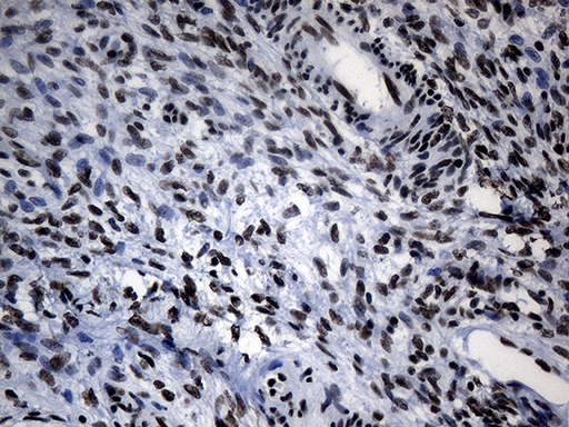 POLR2A / RNA polymerase II Antibody - Immunohistochemical staining of paraffin-embedded Human Ovary tissue within the normal limits using anti-POLR2A mouse monoclonal antibody. (Heat-induced epitope retrieval by 1mM EDTA in 10mM Tris buffer. (pH8.5) at 120°C for 3 min. (1:500)