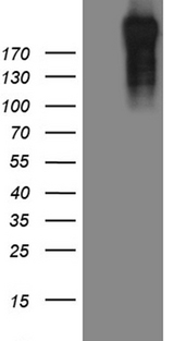 POLR2A / RNA polymerase II Antibody - HEK293T cells were transfected with the pCMV6-ENTRY control. (Left lane) or pCMV6-ENTRY POLR2A. (Right lane) cDNA for 48 hrs and lysed. Equivalent amounts of cell lysates. (5 ug per lane) were separated by SDS-PAGE and immunoblotted with anti-POLR2A. (1:500)