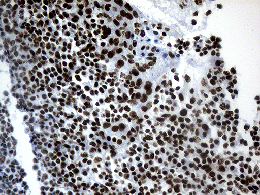 POLR2A / RNA polymerase II Antibody - Immunohistochemical staining of paraffin-embedded Human tonsil within the normal limits using anti-POLR2A mouse monoclonal antibody. (Heat-induced epitope retrieval by 1mM EDTA in 10mM Tris buffer. (pH8.5) at 120°C for 3 min. (1:500)