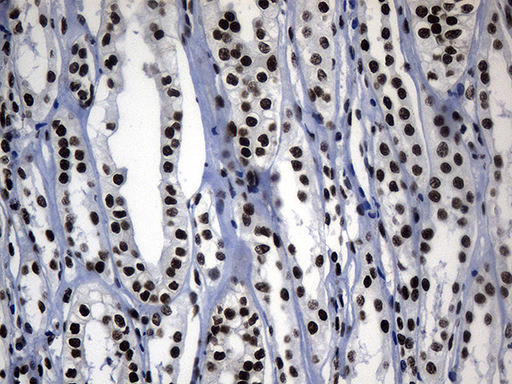 POLR2A / RNA polymerase II Antibody - Immunohistochemical staining of paraffin-embedded Human Kidney tissue within the normal limits using anti-POLR2A mouse monoclonal antibody. (Heat-induced epitope retrieval by 1mM EDTA in 10mM Tris buffer. (pH8.5) at 120°C for 3 min. (1:500)